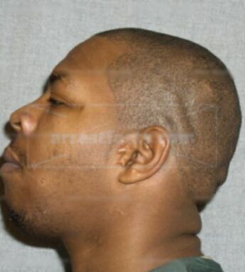 Melvin Malone