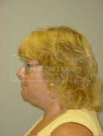 Charlene A Trezek