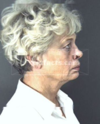 Jean Clark Dixon