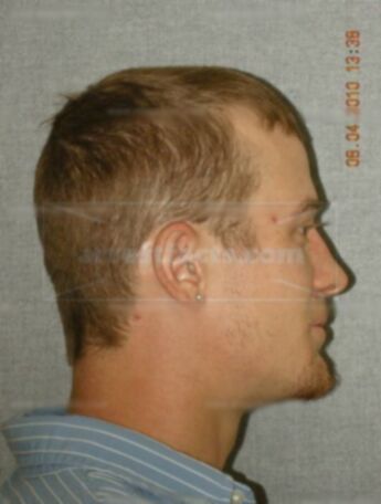 Brandon B Bessett