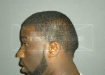 Anthony Rene Benbow