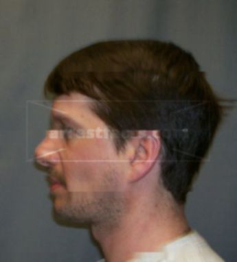 Robert J Bruneau