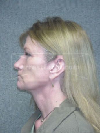 Becky L Nelson