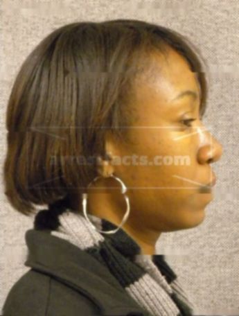 Cassandra L Henderson