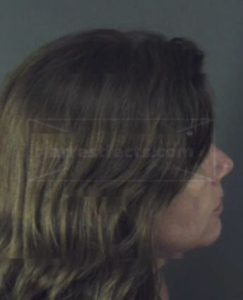 Tammy Lynn Lannert