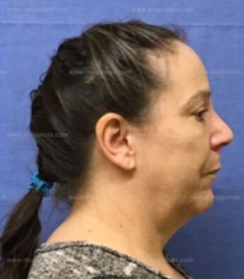 Lisa J Brumley