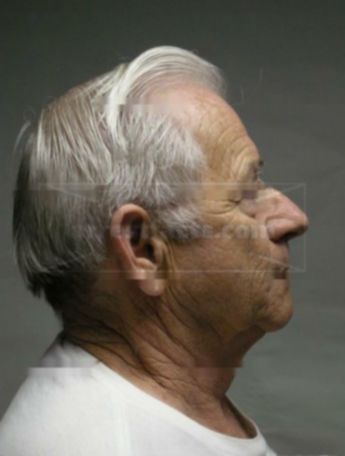 Roger A Brainard