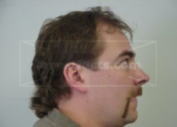 Peter J Kangas