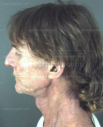 Terry Michael Lynch