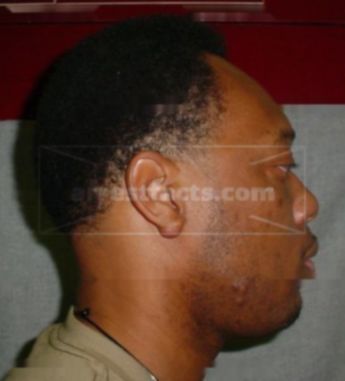 Anthony Jones