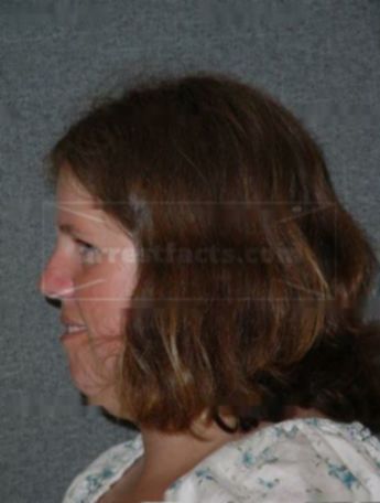 Rebecca T Gustafson