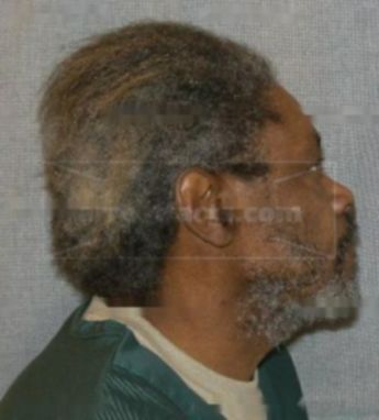 Thomas L Lee