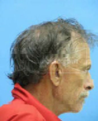 Danny Gene Wright