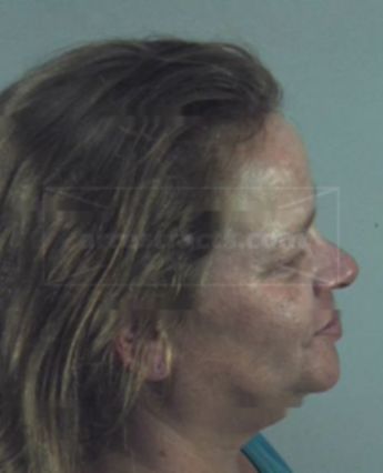 Charlotte Ann Rayl
