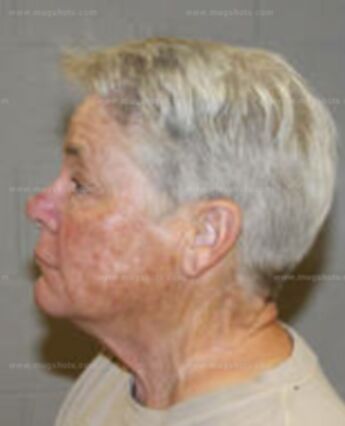 Patsy Kaye Collins