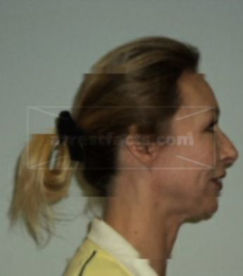 Bonita Barton