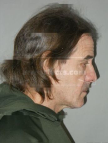 Douglas F Krafjack