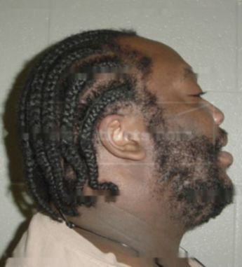 Alonzo Patterson