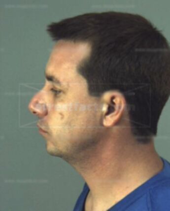 Brian Lee Phillips