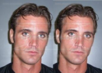 Miles Adam L.