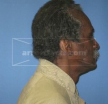 Kenneth Winfield