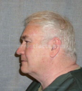 James K Berryman