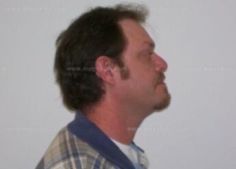 James R Callies