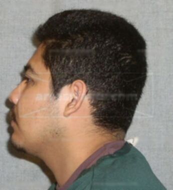 Arnulfo Bonilla