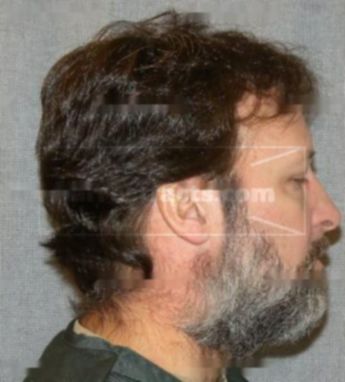 Donald E Kavanaugh Ii