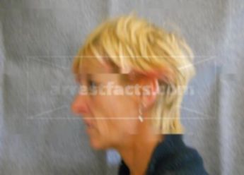 Suzette R Chovan
