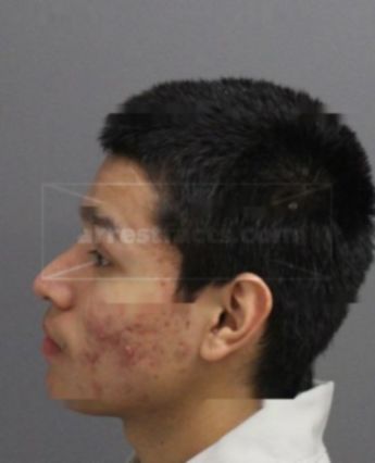 Elijah Carrillo