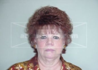 Patricia A Kurtz