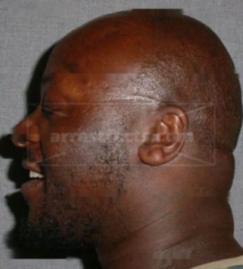 Christophr G Tillman