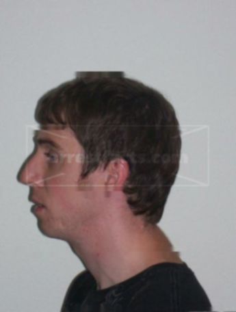 Jason M Keip