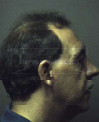 Carlo Anthony Detommaso