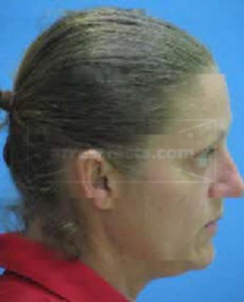 Robin Leigh Rickett