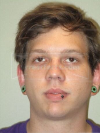 Dustin J Cathman