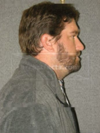 Jason J Schlei