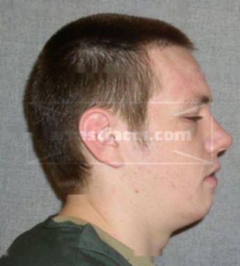Brandon L Garecht