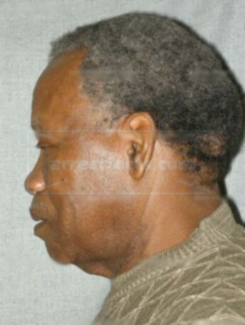Lovell King