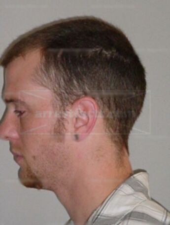 Joel J Dommershausen Jr.