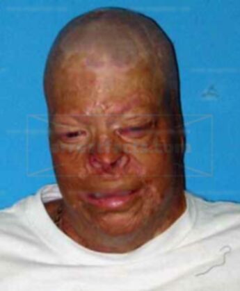Vinton Troy Cannon