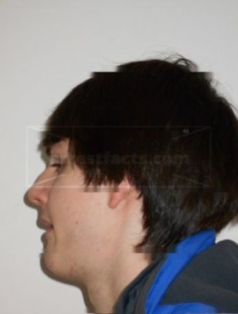 Nickalas J Zurfluh