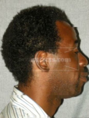 Ward L Jackson