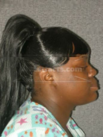 Latoya S Benson