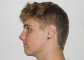 Brandon J Klug