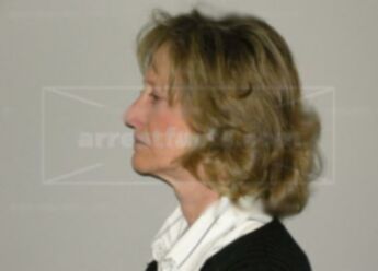 Diana L Baltus