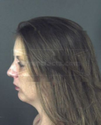 Mindy Lynn Hoffman