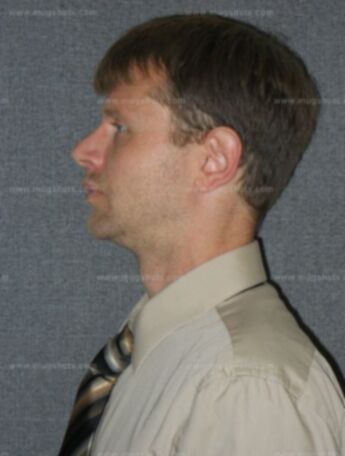 Michael D Ruckert