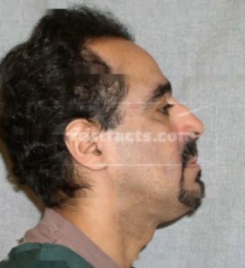 Miguel Calderon